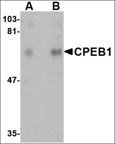 Anti-CPEB1 antibody produced in rabbit