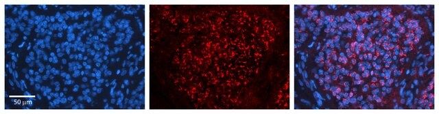 Anti-CPD antibody produced in rabbit
