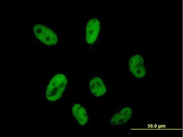 Anti-CPSF2 antibody produced in mouse