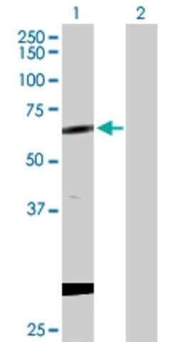 Anti-CPNE1 antibody produced in rabbit
