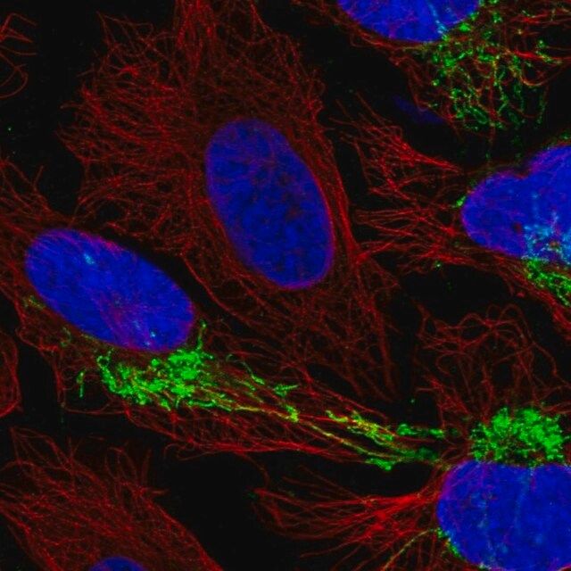 Anti-CPOX antibody produced in rabbit