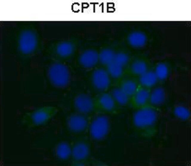 Anti-CPT1B antibody produced in rabbit