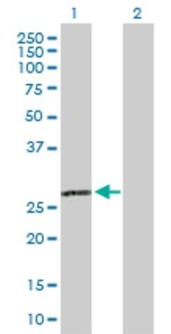 Anti-C1QA antibody produced in rabbit
