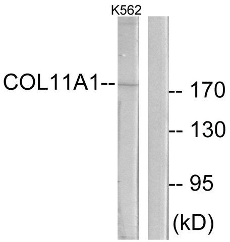 Anti-Collagen XI α1 antibody produced in rabbit
