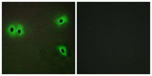 Anti-Collagen XIII α1 antibody produced in rabbit