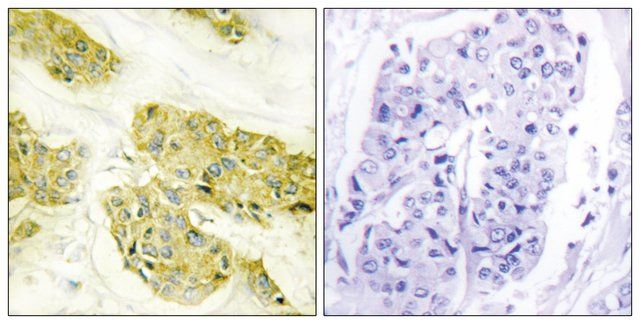 Anti-Collagen V α3 antibody produced in rabbit