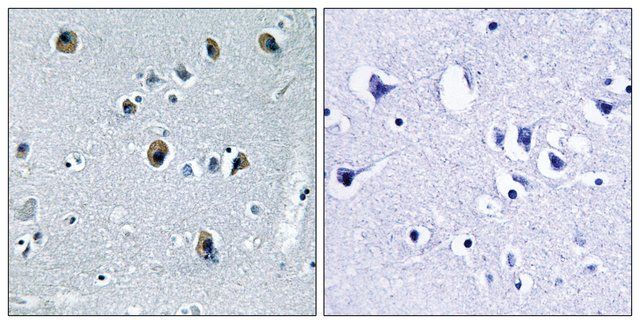 Anti-Collagen XX α1 antibody produced in rabbit