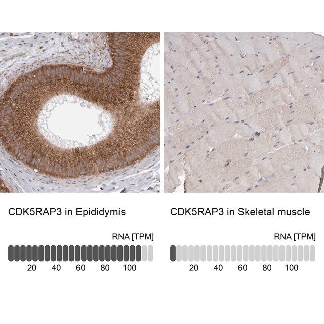 Anti-CDK5RAP3 antibody produced in rabbit