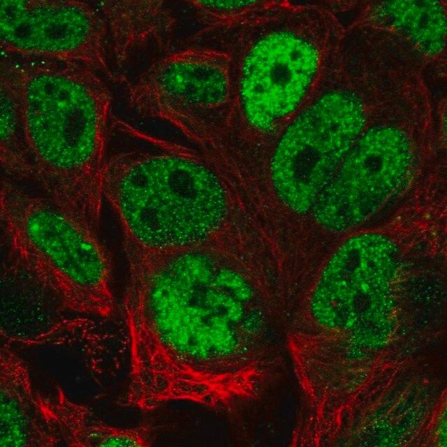 Anti-CDX2 antibody produced in rabbit