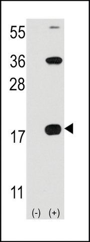 ANTI-CD3Z(C-TERMINAL) antibody produced in rabbit