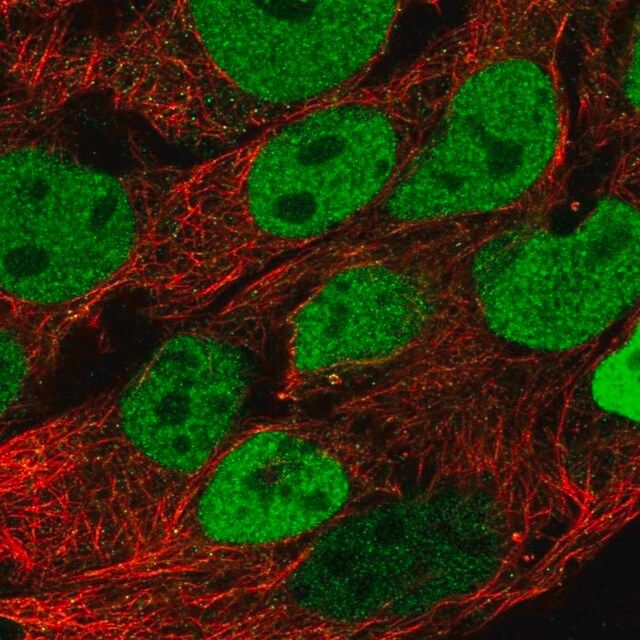 Anti-CDX2 antibody produced in rabbit
