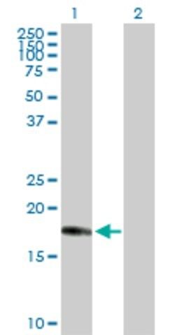 Anti-CENPM antibody produced in rabbit