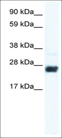 Anti-CDX2 antibody produced in rabbit