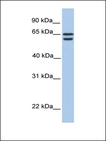 Anti-CDYL2 antibody produced in rabbit