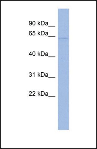 Anti-CDKN2AIP, (N-terminal) antibody produced in rabbit