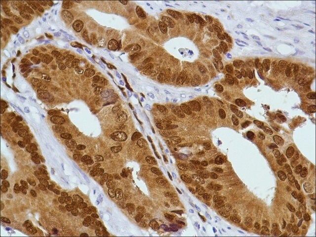 Anti-CDX2 antibody, Rabbit monoclonal