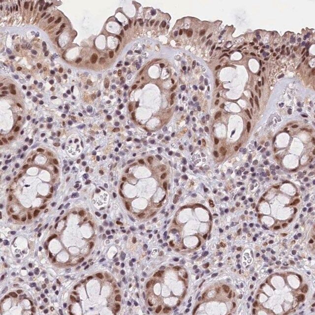 Anti-CDYL2 antibody produced in rabbit