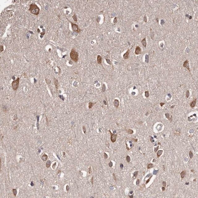 Anti-CELF3 antibody produced in rabbit