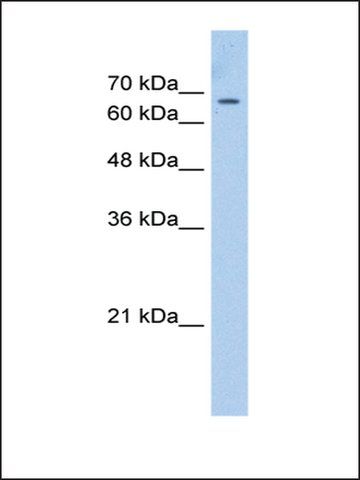 Anti-CDY1 antibody produced in rabbit