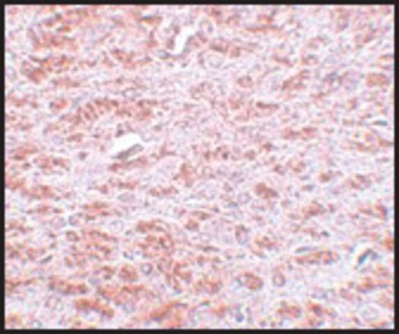 Anti-CDX2 antibody produced in rabbit