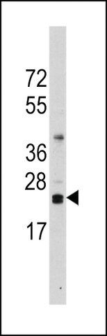 ANTI-CD3Z(N-TERMINAL) antibody produced in rabbit