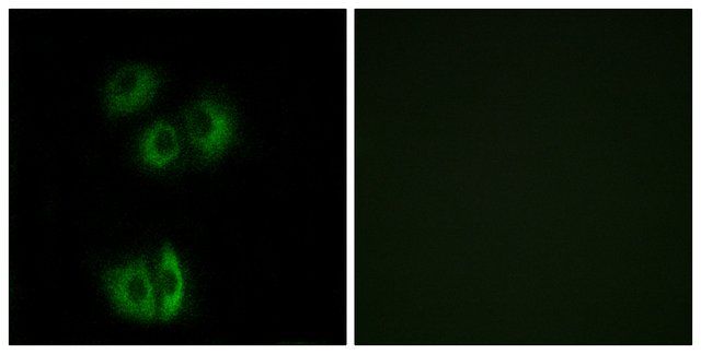 Anti-CELSR3 antibody produced in rabbit