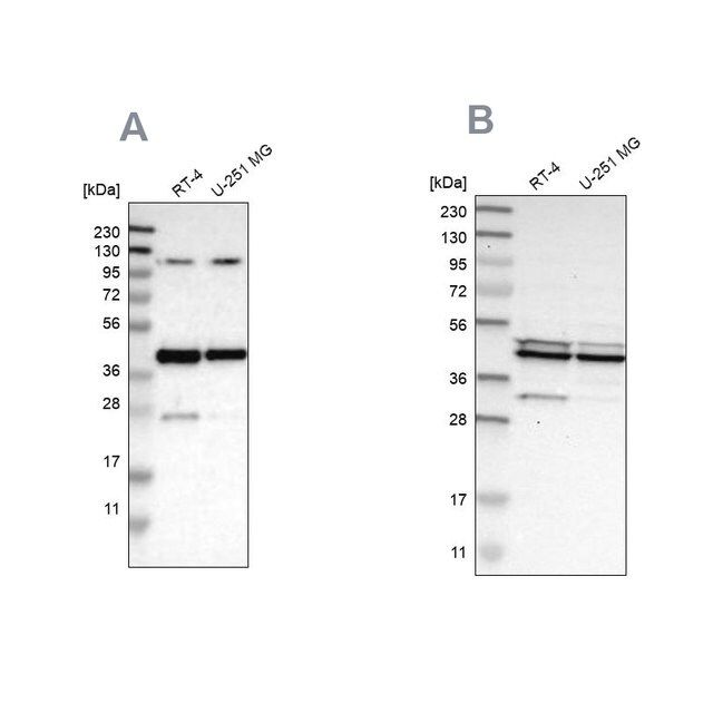 Anti-CFAP36 antibody produced in rabbit