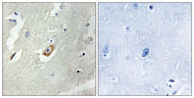 Anti-CDC16 antibody produced in rabbit