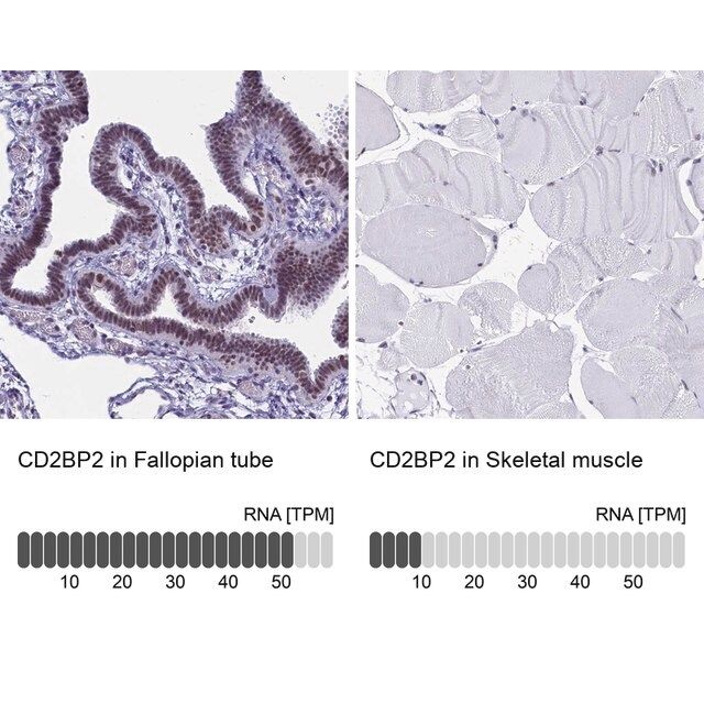 Anti-CD2BP2 antibody produced in rabbit