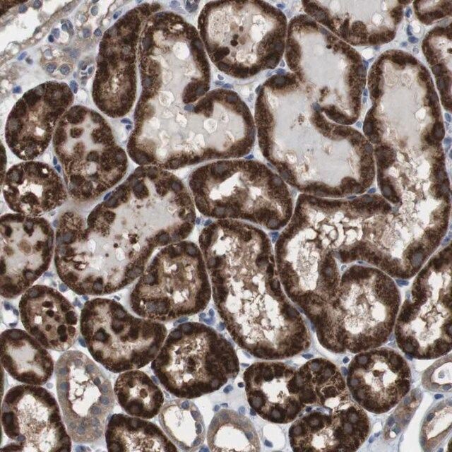 Anti-CDC34 antibody produced in rabbit