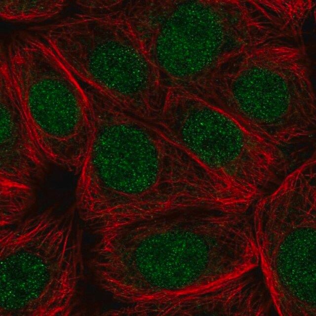Anti-CDC73 antibody produced in rabbit