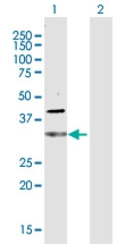 Anti-CDC34 antibody produced in rabbit