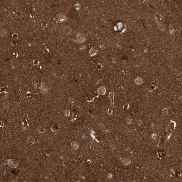 Anti-CDC42EP4 antibody produced in rabbit