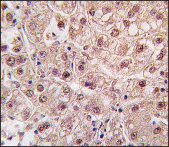 Anti-CDCA8 (center) antibody produced in rabbit