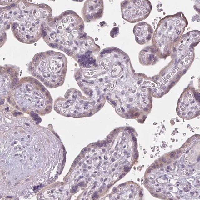 Anti-CDH19 antibody produced in rabbit