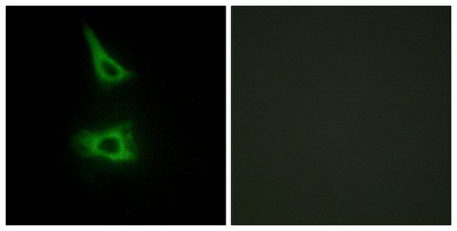 Anti-CDH17 antibody produced in rabbit