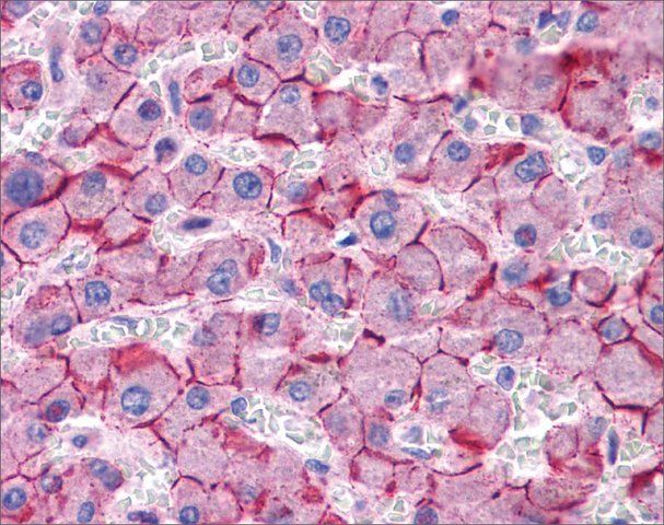Anti-CDH1 antibody produced in rabbit