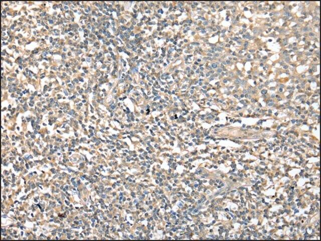 Anti-CD1D