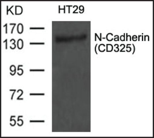 Anti-CDH2 antibody produced in rabbit