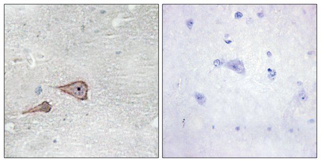 Anti-CDH3 antibody produced in rabbit