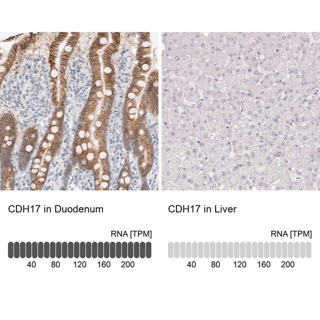 Anti-CDH17 antibody produced in rabbit