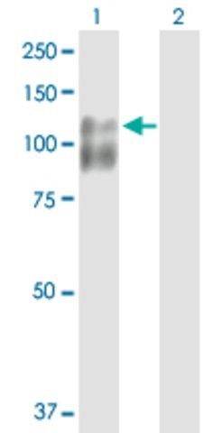 Anti-CDH3 antibody produced in rabbit