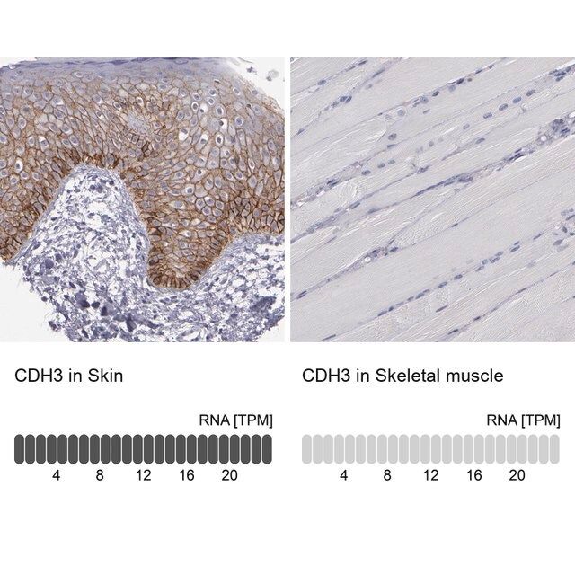 Anti-CDH3 antibody produced in rabbit