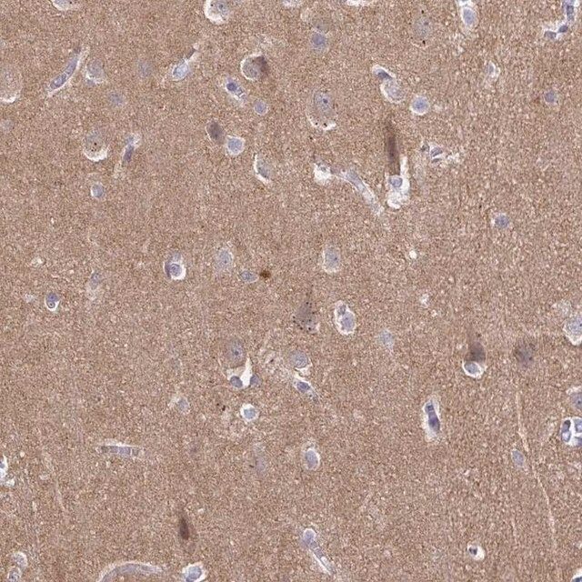 Anti-CDH18 antibody produced in rabbit