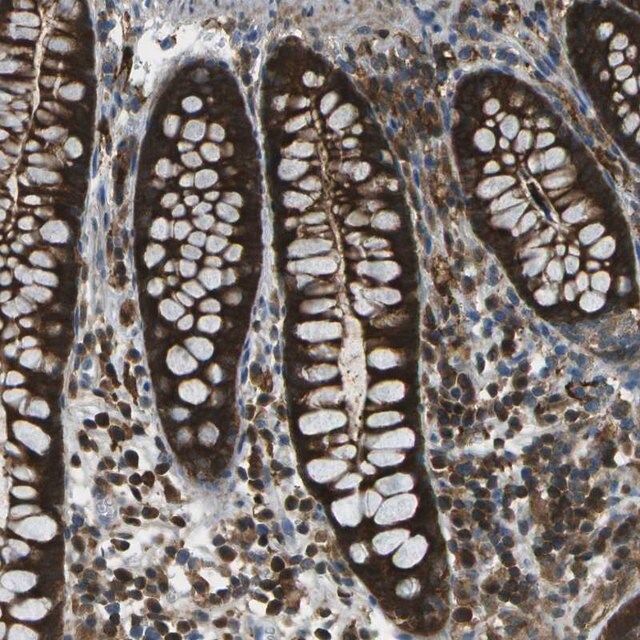 Anti-CDH23 antibody produced in rabbit