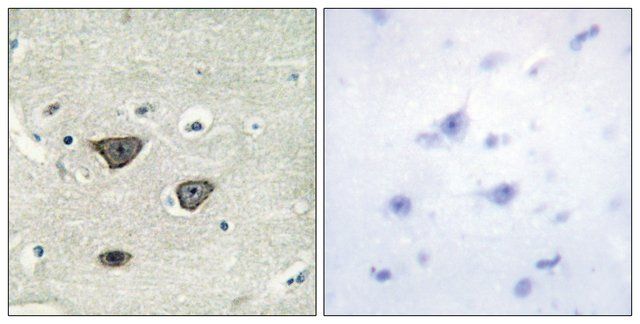 Anti-CDH8 antibody produced in rabbit