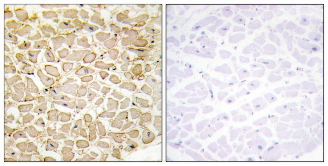 Anti-CDH13 antibody produced in rabbit
