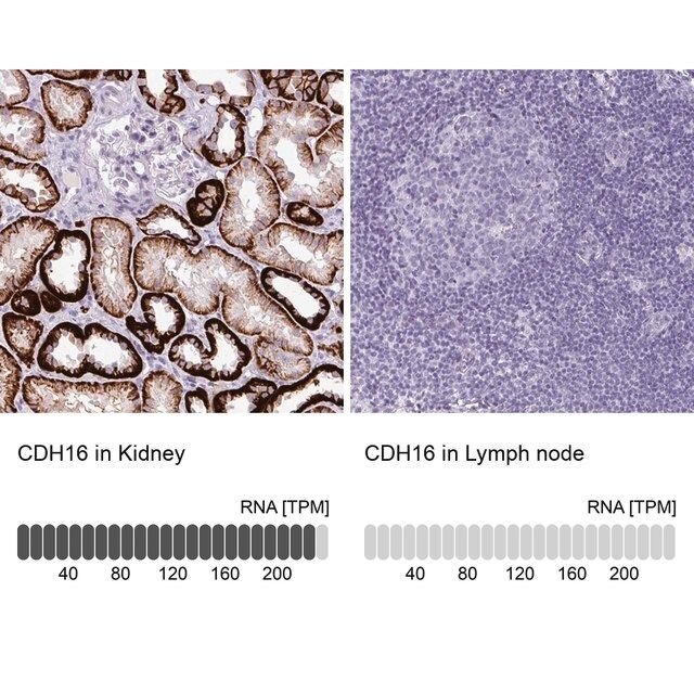 Anti-CDH16 antibody produced in rabbit