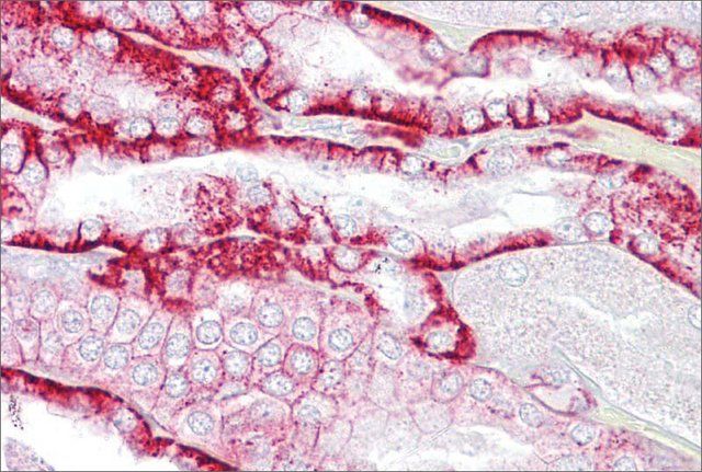 Anti-CDH16 antibody produced in rabbit