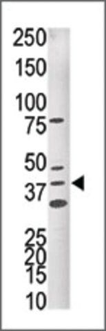 Anti-CDK10 (N-term R5) antibody produced in rabbit